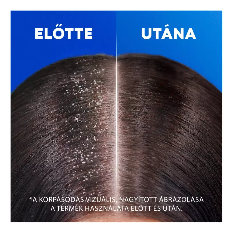 Head & Shoulders sampon 400 ml Citrus Fresh Kép