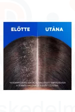 Head & Shoulders sampon 400 ml Citrus Fresh Kép