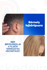 Head & Shoulders sampon 400 ml Citrus Fresh Kép