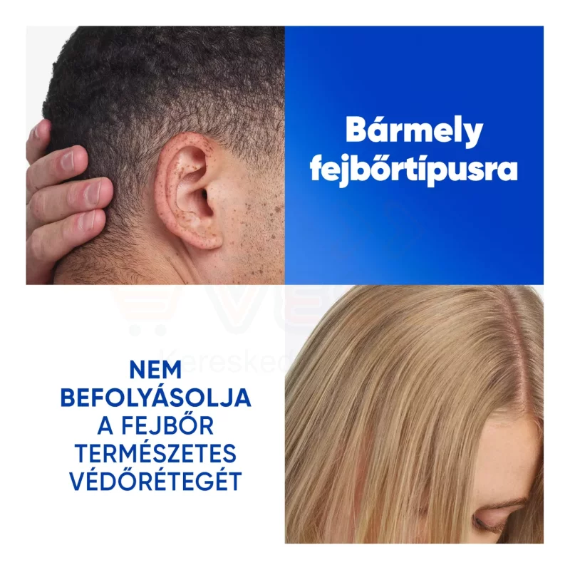 Head & Shoulders sampon 400 ml Citrus Fresh Kép