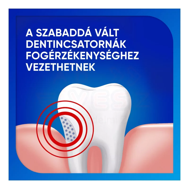 Sensodyne Fluorid fogkrém 75 ml Kép