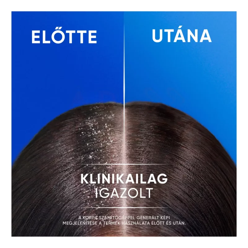 Head & Shoulders sampon 400 ml Classic Clean 2in1 Kép