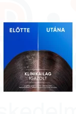 Head & Shoulders sampon 400 ml Classic Clean 2in1 Kép